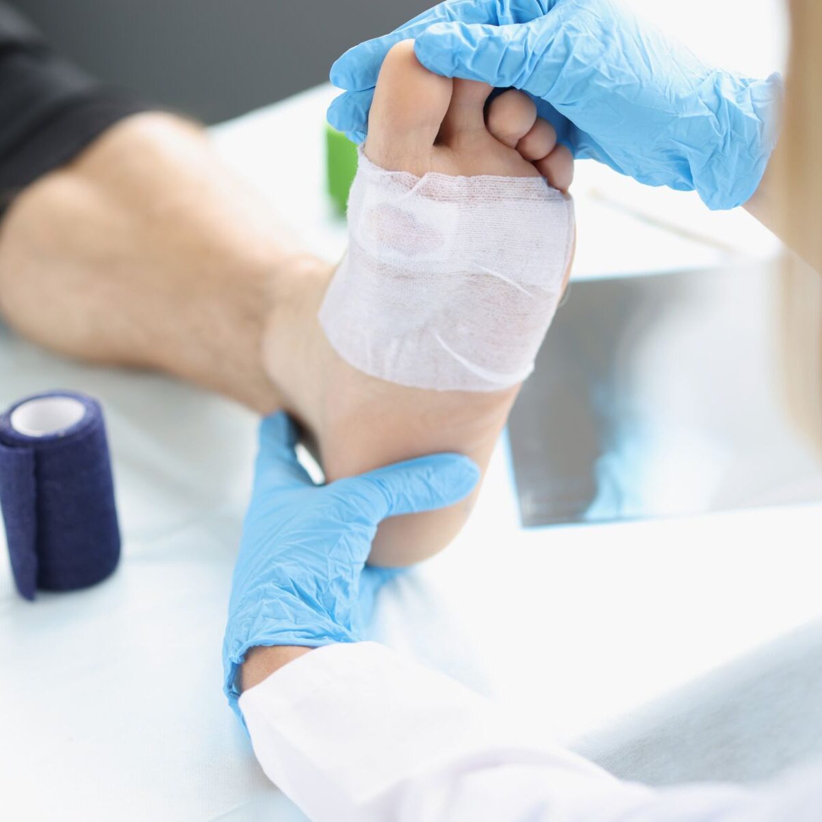 Doctor,Hand,Touches,And,Examines,Wound,On,Leg.,Medical,Concept